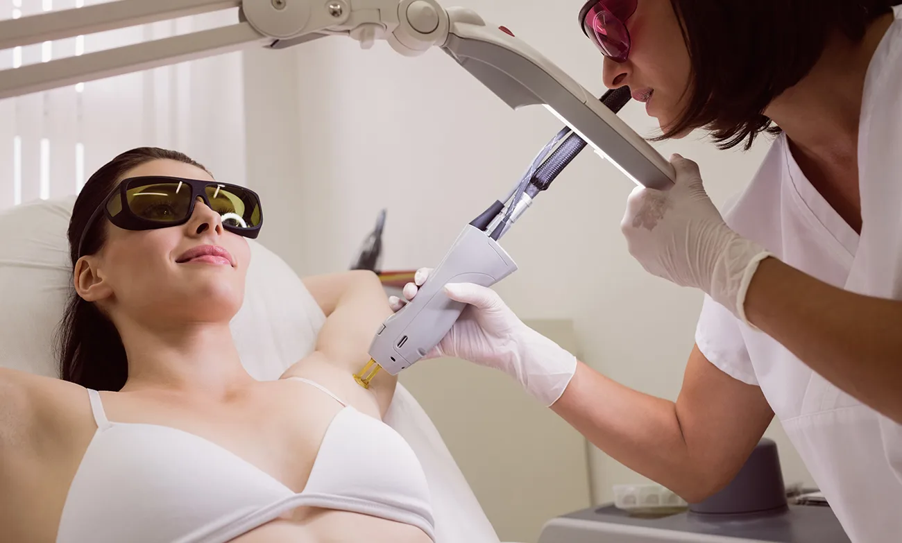 épilation laser