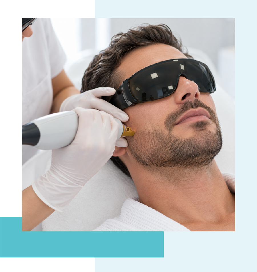 Épilation-laser Barbe
