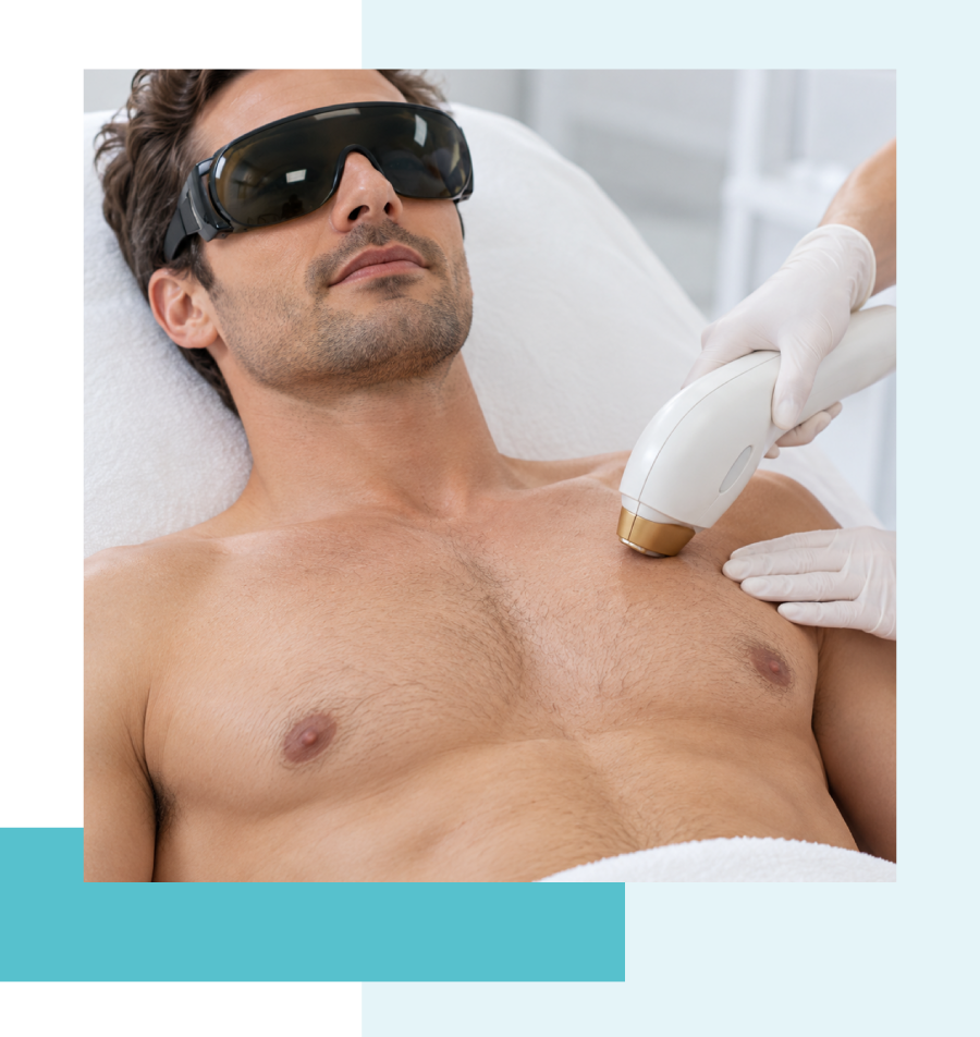 Épilation-laser-homme Torse